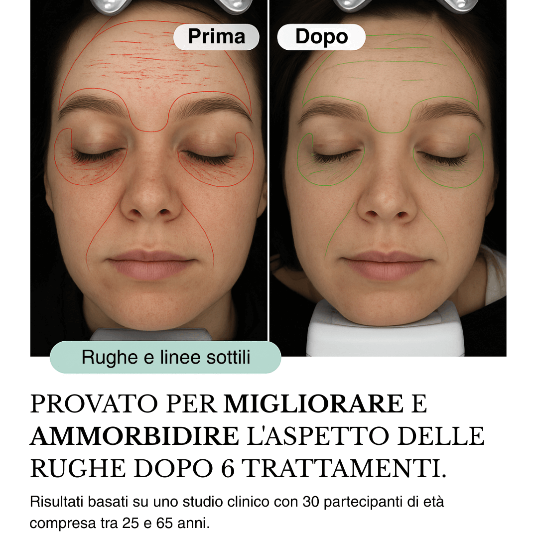 Sistema ad infusione Microneedling Anti-age