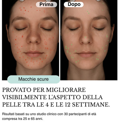 Sistema ad infusione Microneedling Anti-age