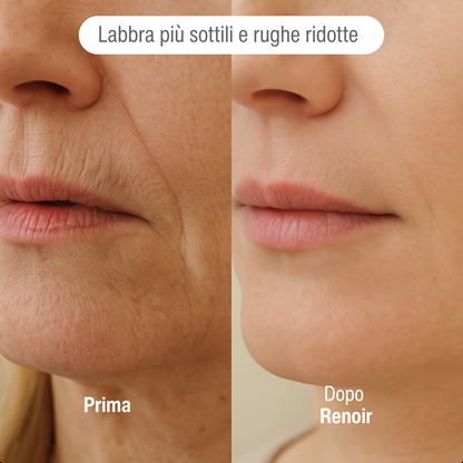 Sistema ad infusione Microneedling Anti-age